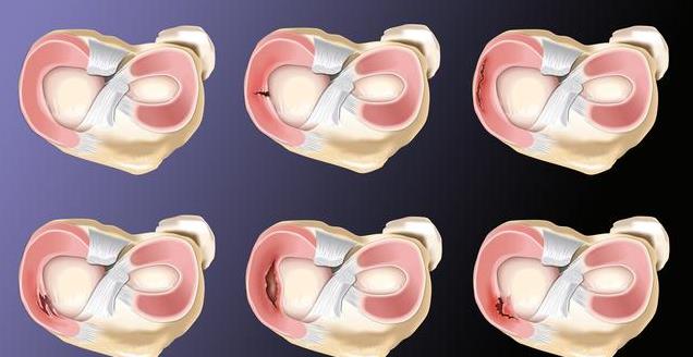 EM, 休息是第一, 具体选哪种